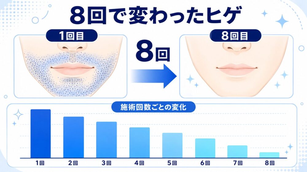 ヒゲ脱毛の変化イメージ（ビフォーアフター・カレンダーとグラフで表現）